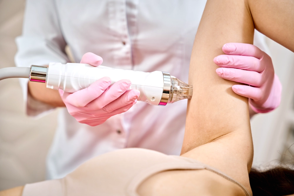 Armbehamdlung mit Microneedling